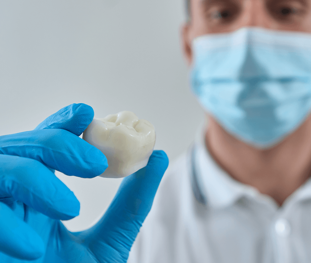 Crowns for Teeth
